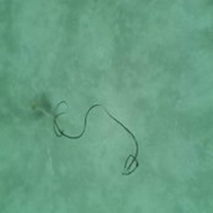 Karadeniz’de 'mikroplastik' tehlikesinde ‘nehir’ etkisi 1