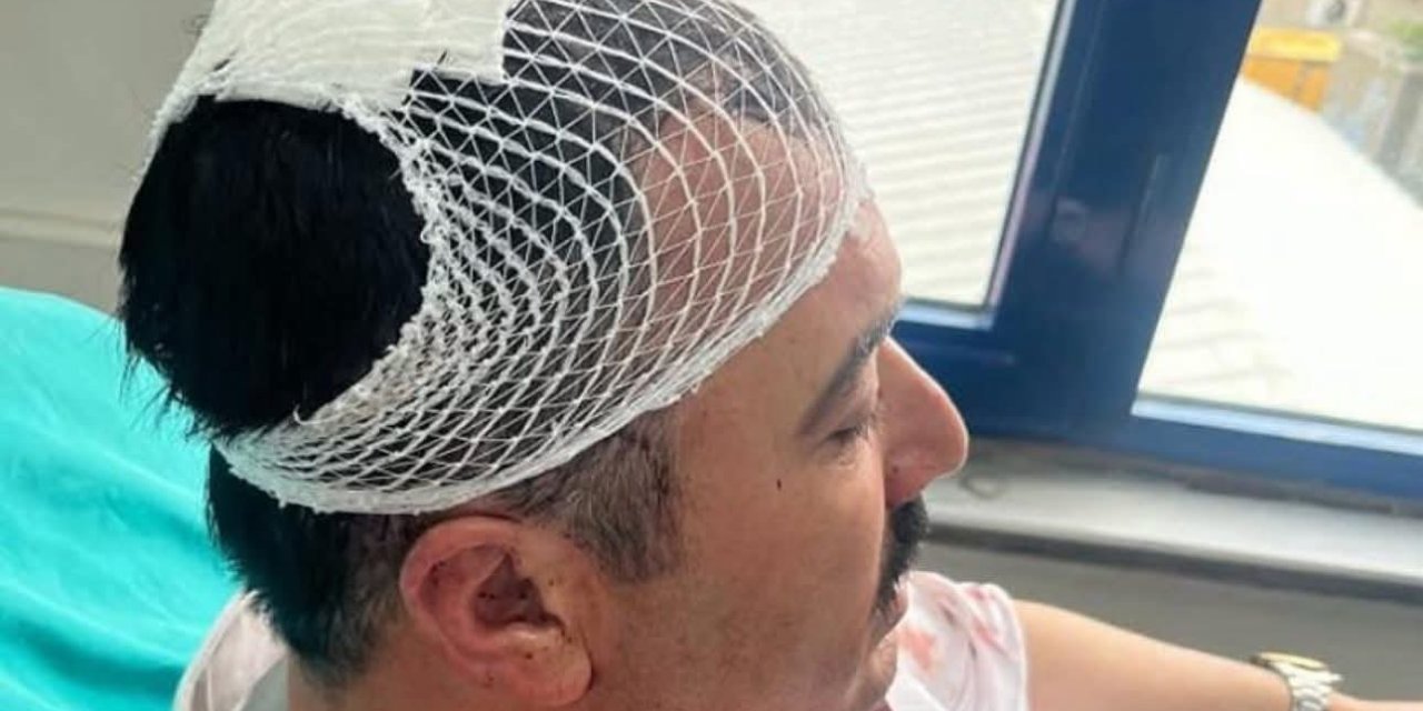 YRP'li İl Başkan Yardımcısı, Belediye Başkan Yardımcısı’nı şekerlikle başına vurarak yaraladı