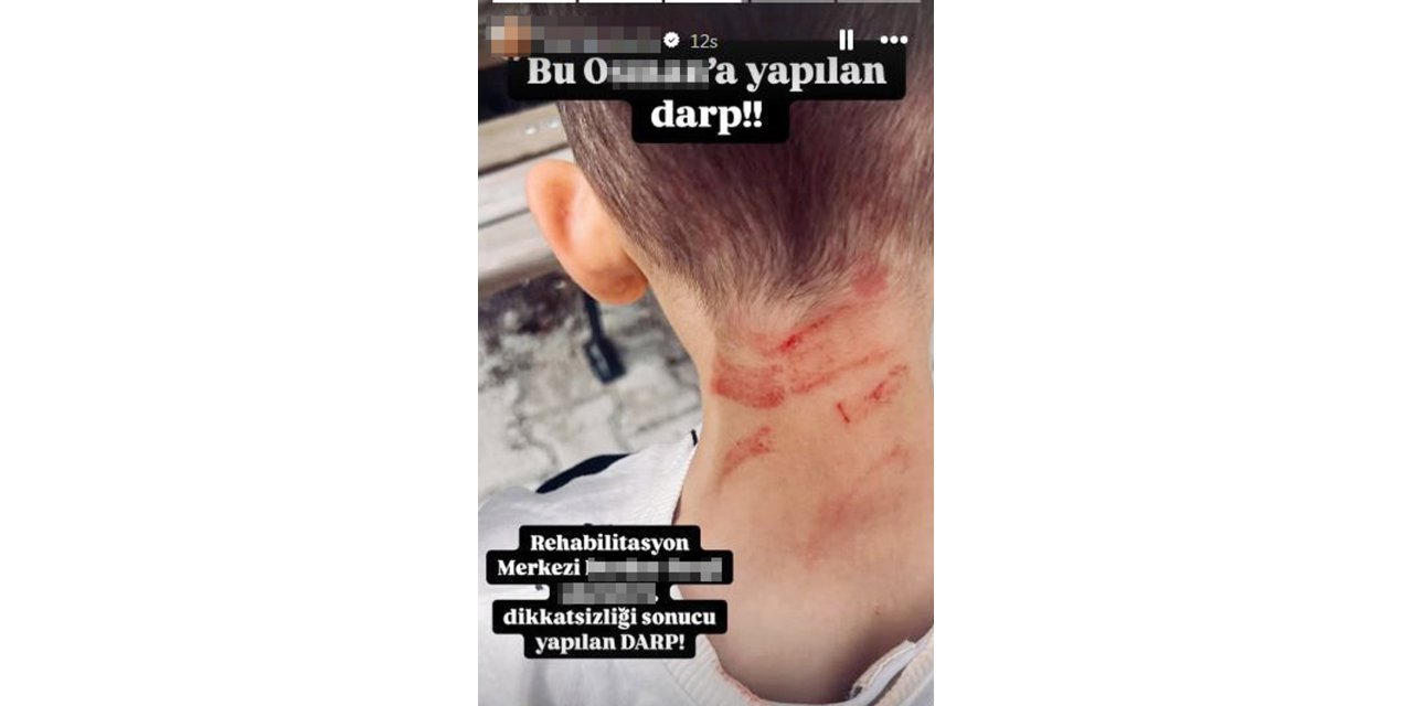 Rehabilitasyon merkezinde 5 yaşında çocuğa darp iddiasına soruşturma