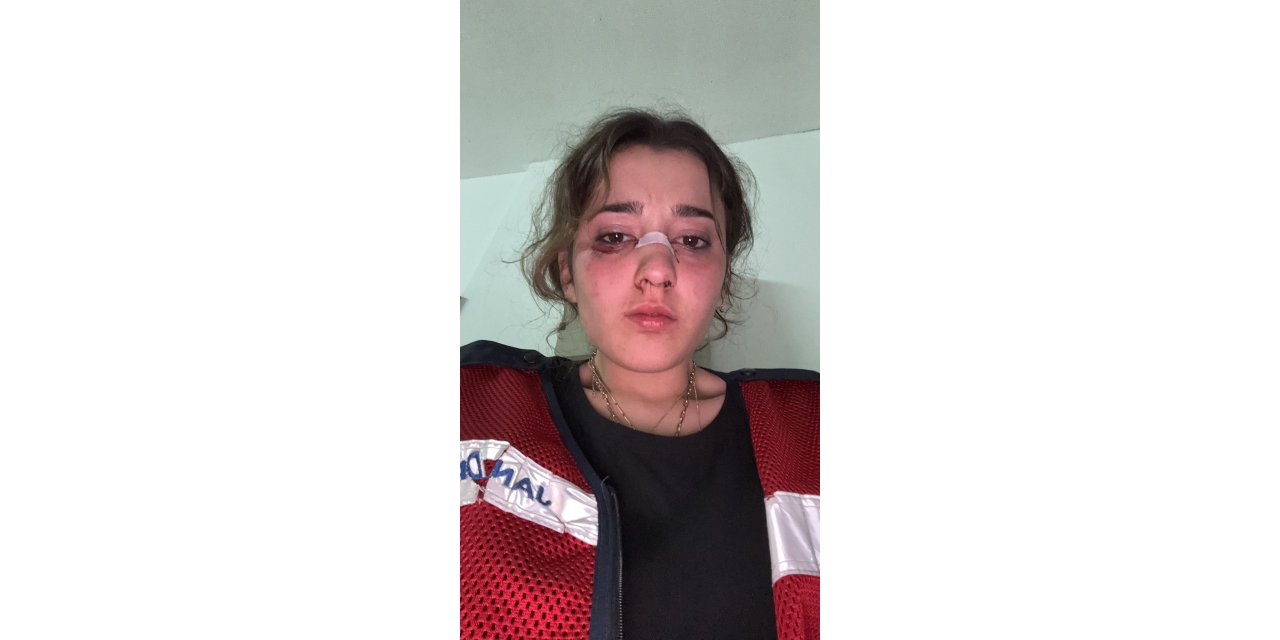 İstanbul - Tatil dönüş planı tartışmasında nişanlısını plajda motosiklet kaskıyla dövdü