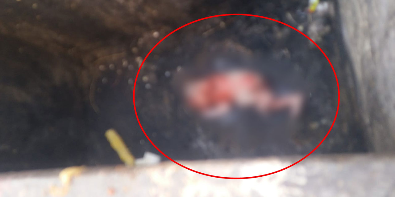 Doğurup çöp konteynerine attığı bebeği esnaf fark etti; anne gözaltında