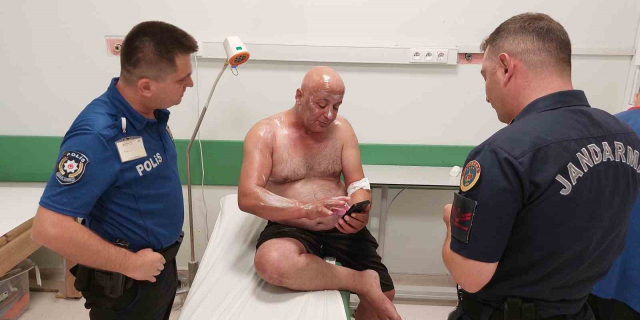 Tır sürücüsü tüpgaz parlaması sonucu yanarak hastanelik oldu