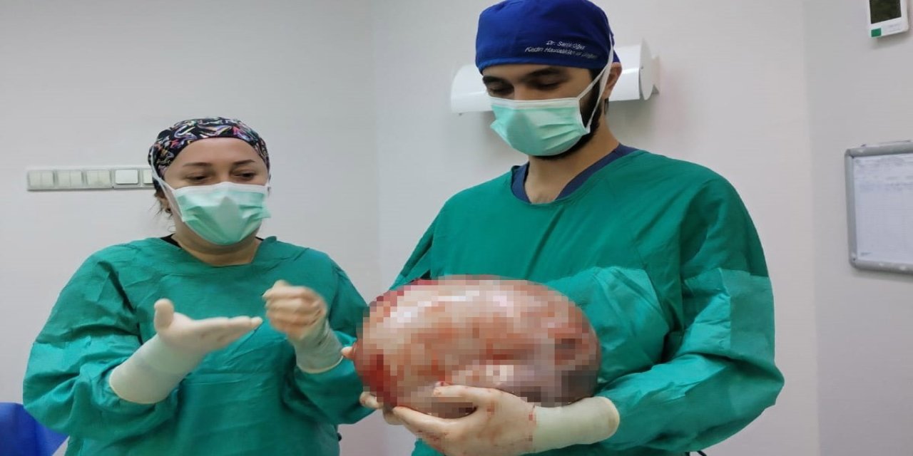 Karnı 2 ayda 9 aylık hamile gibi büyüyen kadının içinden karpuz kadar kitle çıkarıldı