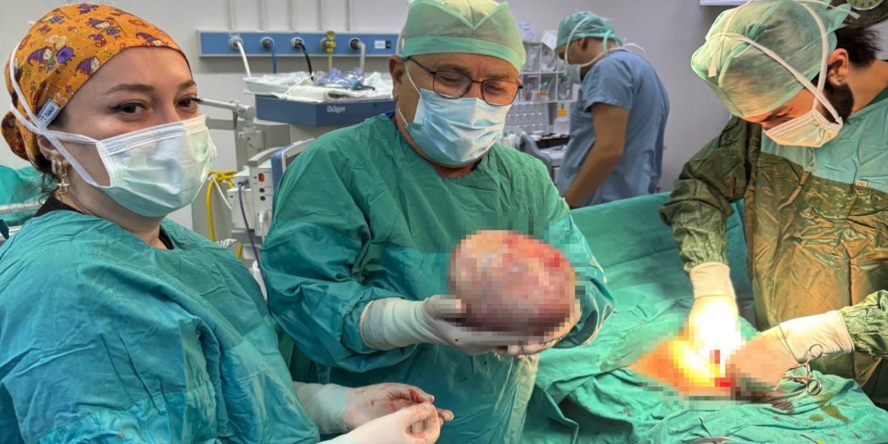 60 yaşındaki kadının şişen karnından 6 kiloluk kitle çıkarıldı