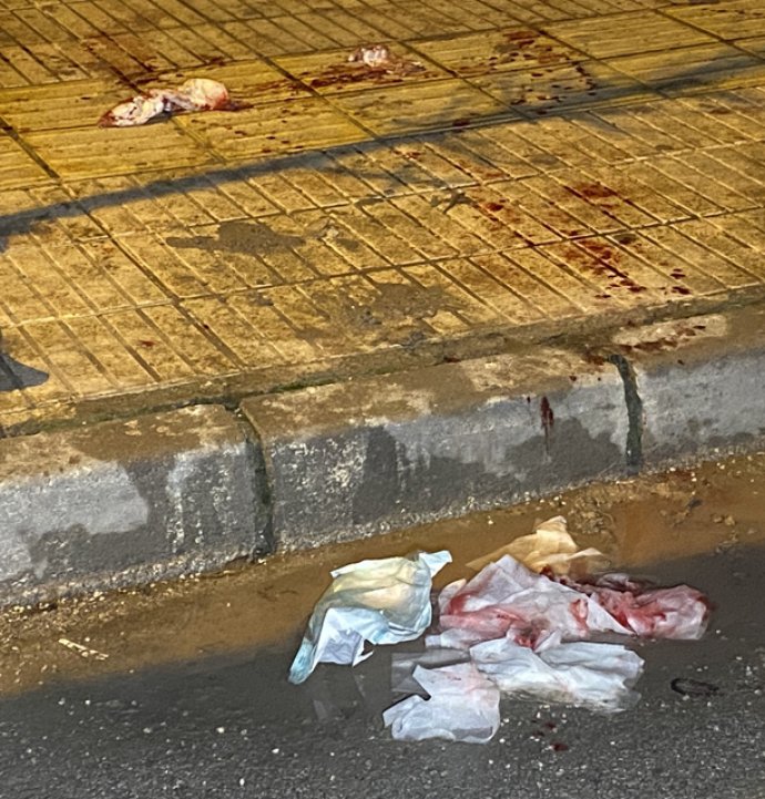 Çorum’da bıçaklı kavga: 1 yaralı