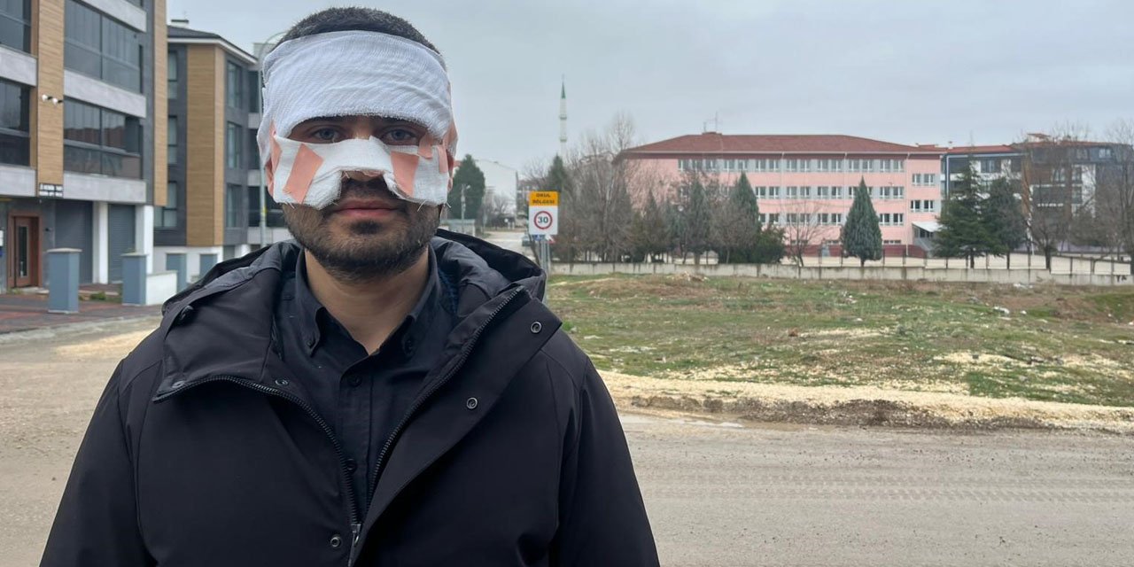 Rehber öğretmenin yüzüne sıcak çay fırlattığı fizik öğretmeni feci şekilde yandı