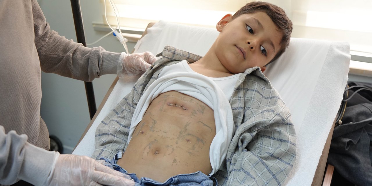 Çocuklarda nadir görülen diyafram fıtığı Samsun'da ilk kez tedavi edildi