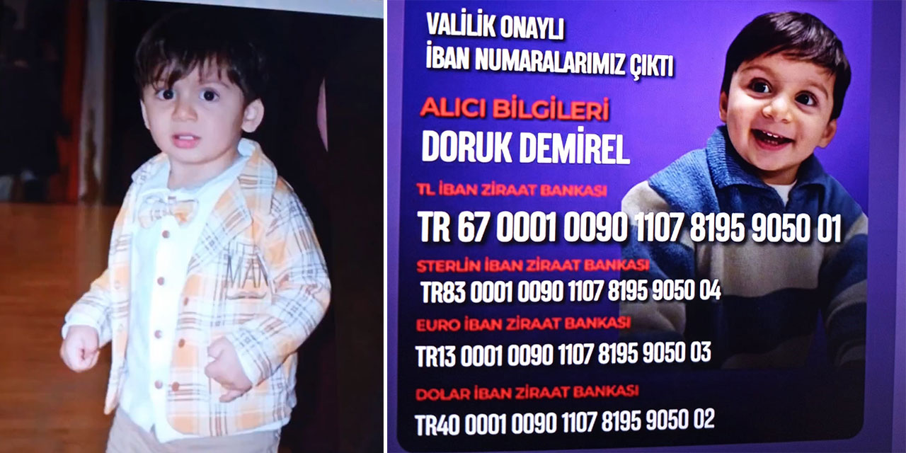 Rizeli Doruk Bebeğin Tedavisi İçin 3 Milyon Dolar Gerekiyor