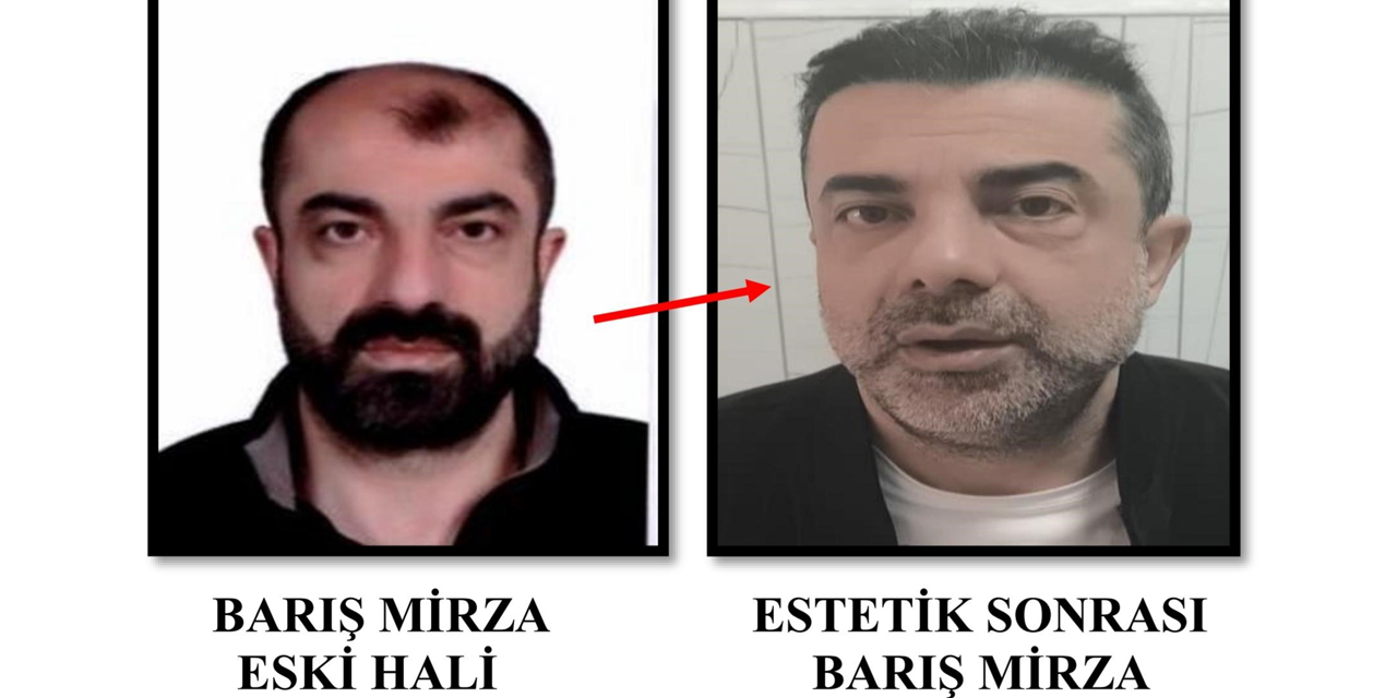 Ameliyat ile yüzünü değiştiren firari cinayet zanlısı, 7 yıl sonra yakalandı