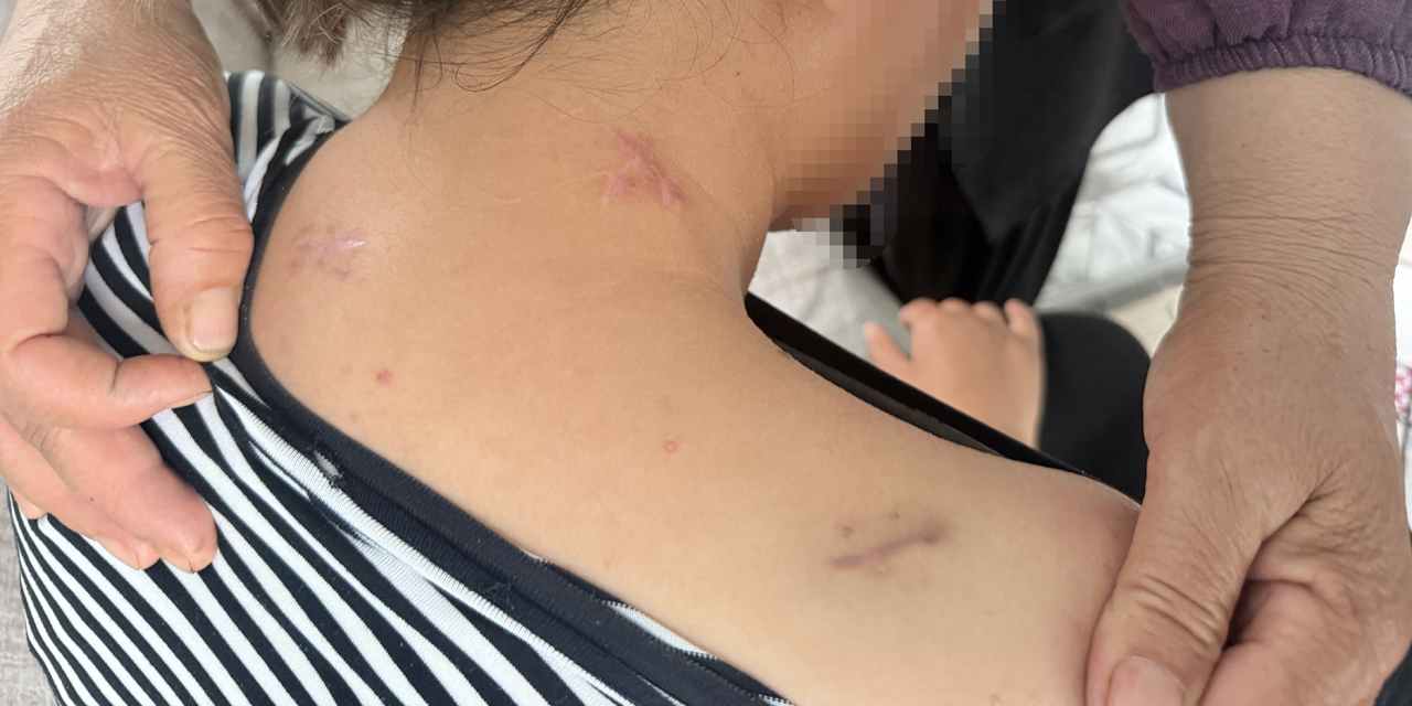 17 bıçak darbesi aldı, ölü numarasıyla kurtuldu, kocasının en ağır cezayı almasını istedi