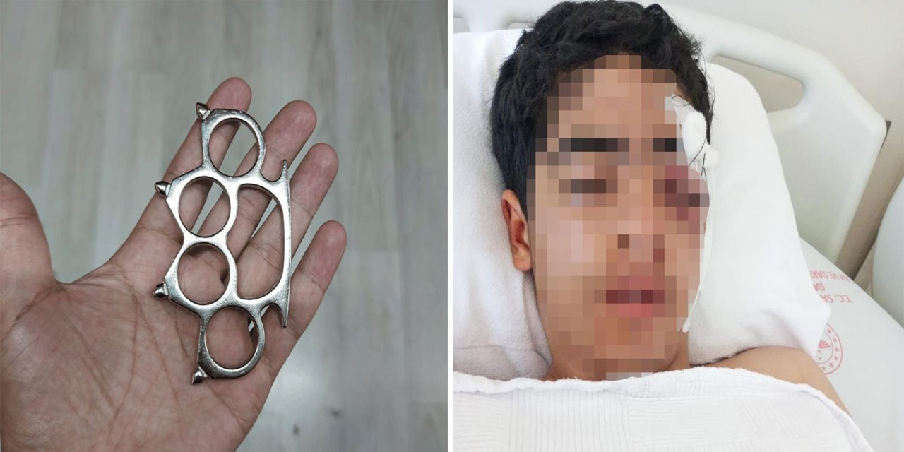 Akran zorbalığına bir yenisi eklendi: 15 yaşındaki çocuk muştayla öldüresiye dövüldü