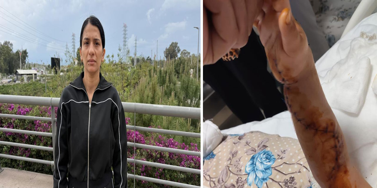 Tomografiye giren 1,5 yaşındaki çocuğun başına gelmeyen kalmadı