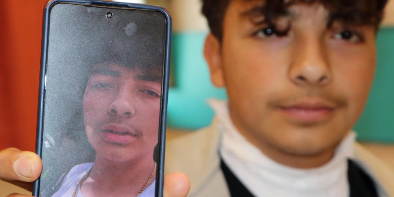 Üzerine Yıldırım Düşen Gencin Boynundaki Kolye Parçalandı; Bulunduğu Bölge Yandı