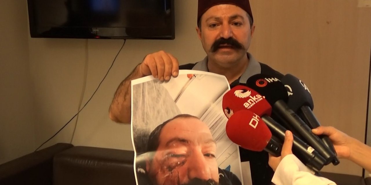 Sosyal Medya Fenomeninden Kendisini Darbeden Ev Sahibinin Kardeşinin Tahliyesine Tepki