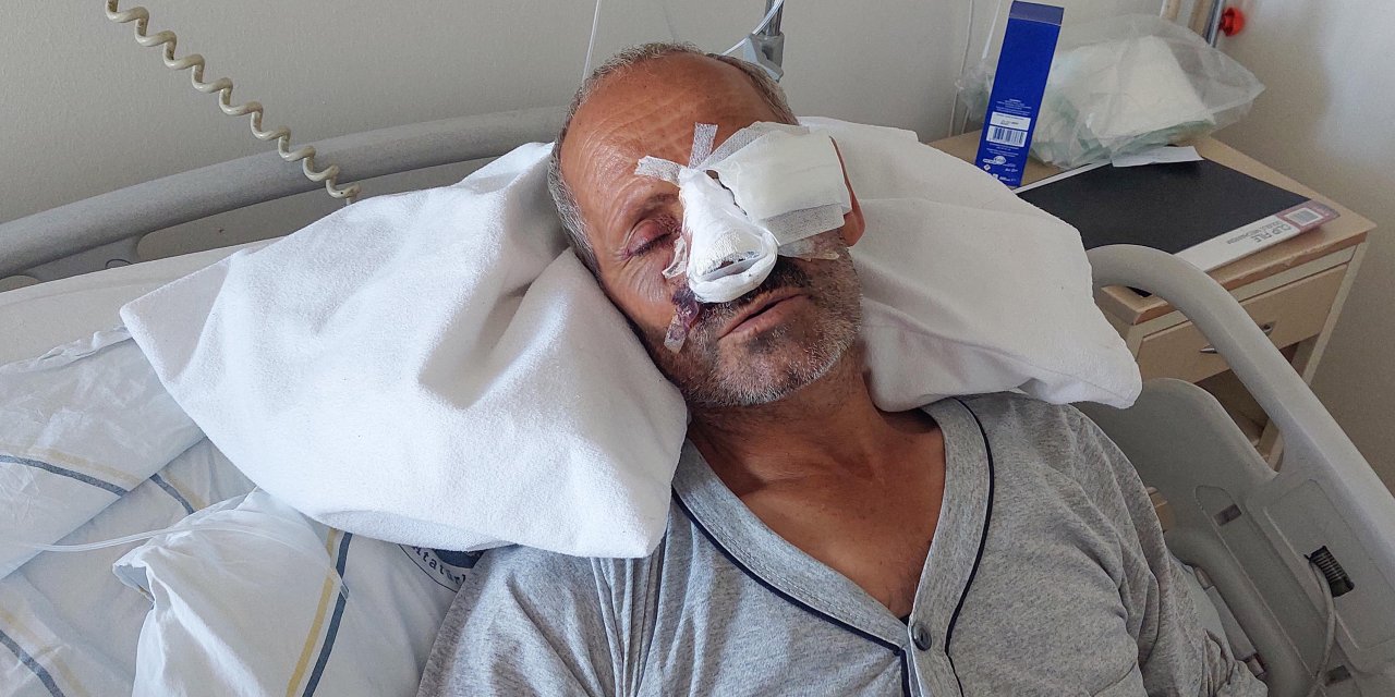 Elektrikli Testere Yüzünü Kesti; Gözünü Kaybetme Riski Var