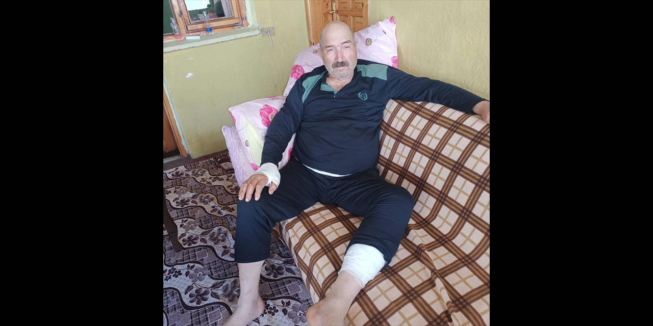 Artvin’de Ayının Saldırısına Uğrayan Şahıs Yaşadığı O Dehşet Anlarını Anlattı