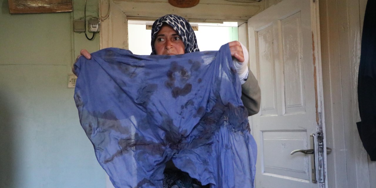 Köyde Hayvanları Otlatma Kavgasında Darbedildi