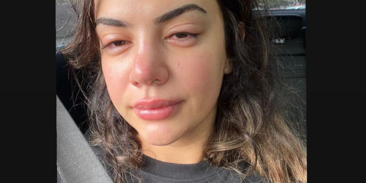 Ece Ronay Sosyal Medyadan Yardım İstedi: "Defalarca Ölüm Tehditi Aldım"