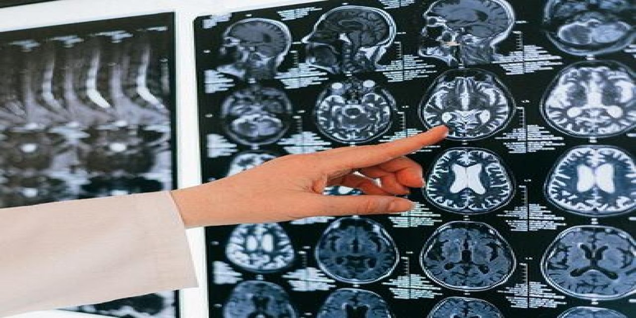 “Serebral Palsili Çocuklar İçin Konforlu Bir Yaşam Mümkün”