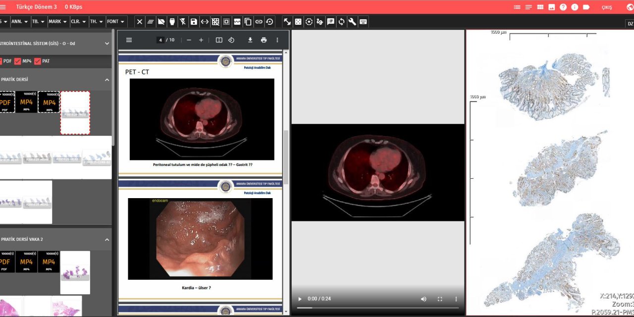 Ankara Üniversitesi'nden Yerli Ve Milli Patoloji Yazılım Programı