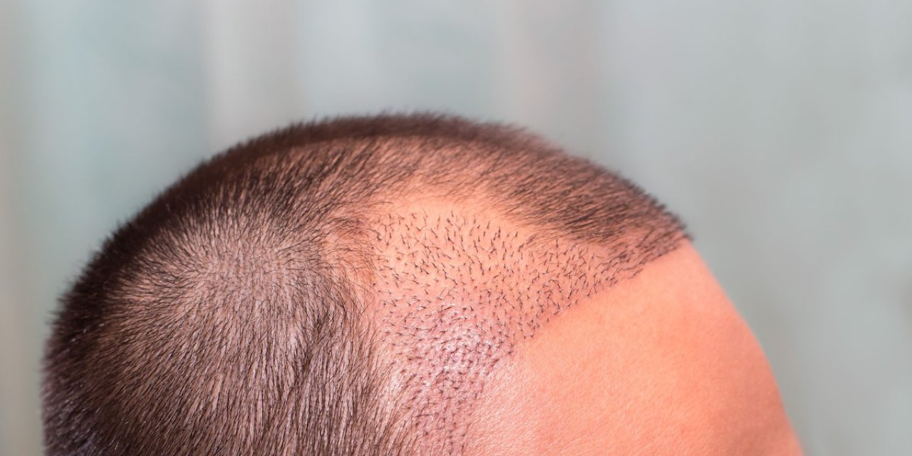 “Yerel Pazarda Önemli Bir Noktada Konumlanıyoruz”