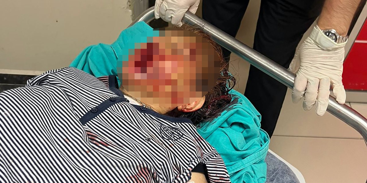 Tartıştıkları Torunları Demir Kürek İle Darbetti