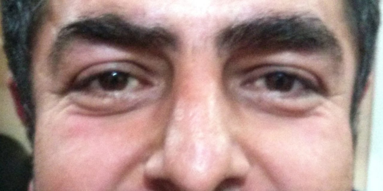 Düğünde Havaya Ateş Açan Magandanın Kurşunuyla Öldü