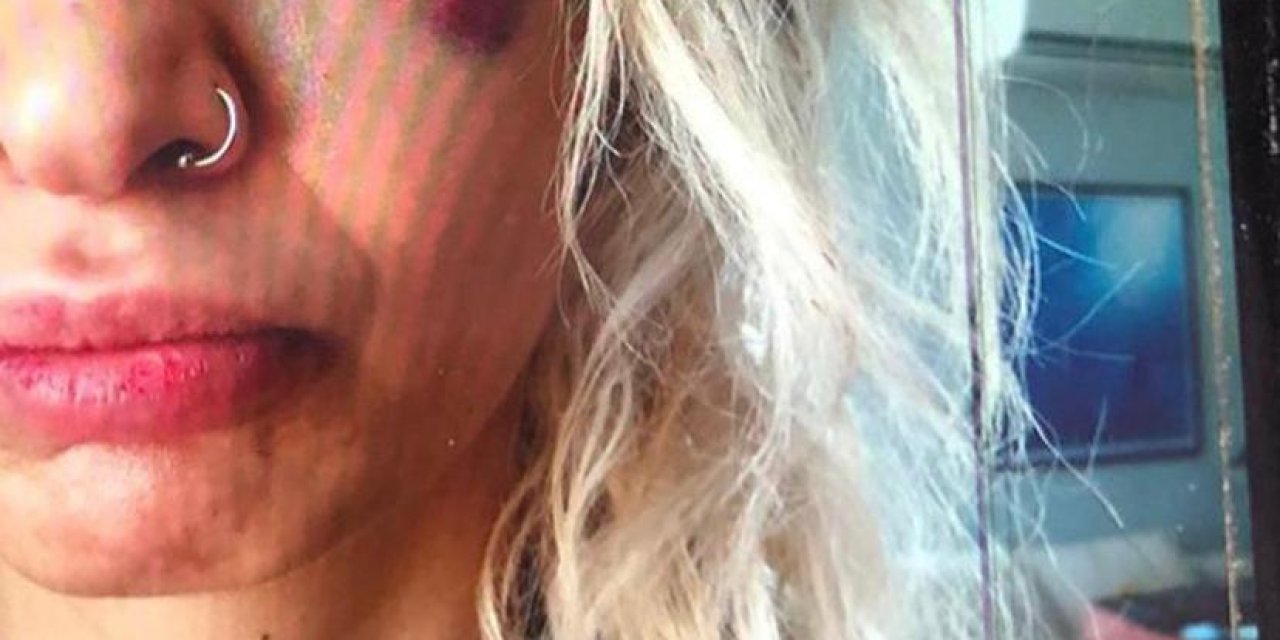 Yüzyüzeyken Konuşuruz'un Gitaristine Sevgilisini Darbettiği İddiasıyla Soruşturma