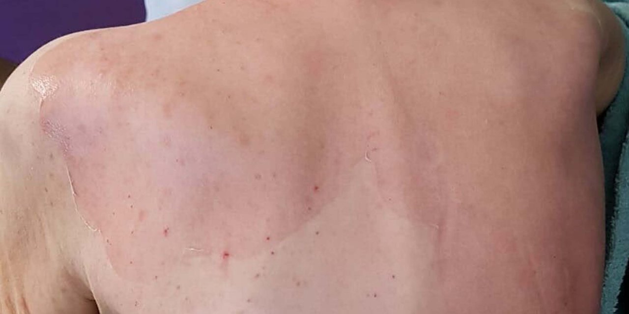 Huzurevindeki Ölümde Beklenen Rapor Geldi: Dermatolojik Hastalık Tespit Edilmedi