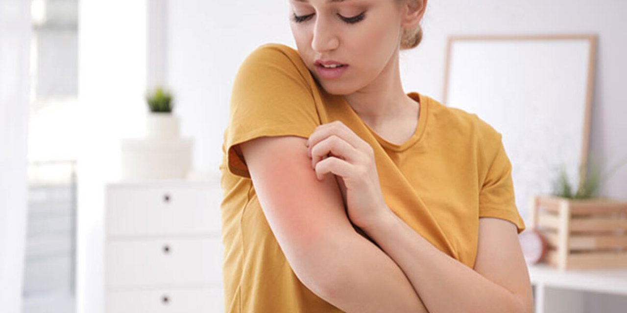 Uzmanı Uyardı: Mağazada Denenen Kıyafetlerden Uyuz Bulaşabilir