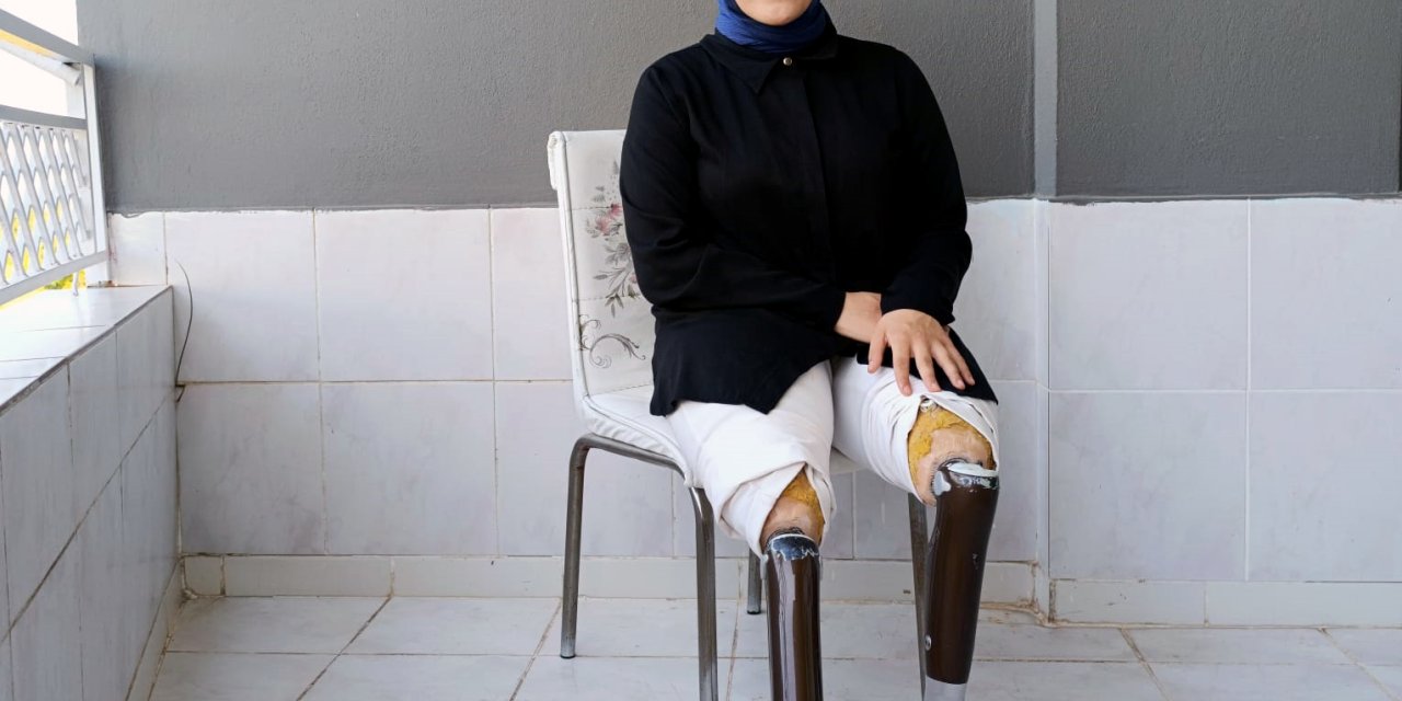 Zeynep'ten Yeni Protez Bacakları İçin Başlattığı Yardım Kampanyasına Destek Çağrısı