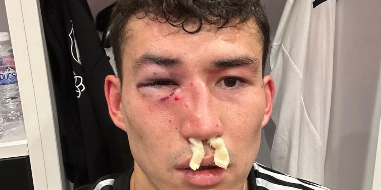 Zaynutdinov Hastaneye Kaldırıldı