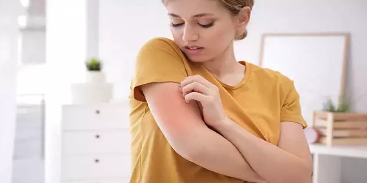 “Kliniklerdeki Uyuz Vakaları Yüzde 25’e Yükseldi”