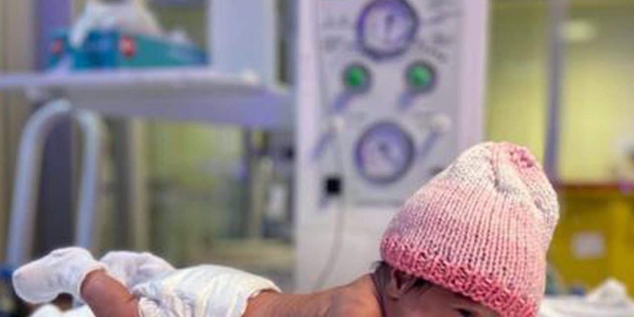 515 Gram Doğan Elif Bebek, 98 Günlük Tedavi Sonrası Hayata Tutundu