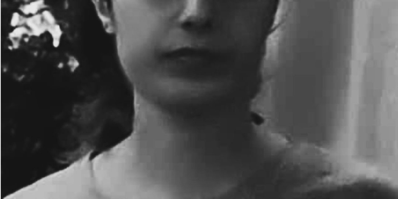 Otomobilin Çarptığı Behiye, 17 Gün Sonra Yaşamını Yitirdi