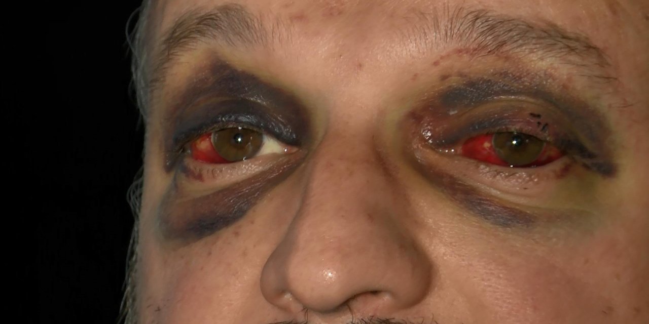 Müzisyeni, ‘Çiftetelli’ Müziği İçin Döven 8 Sanığa Takdir İndirimli Ceza Ve Erteleme