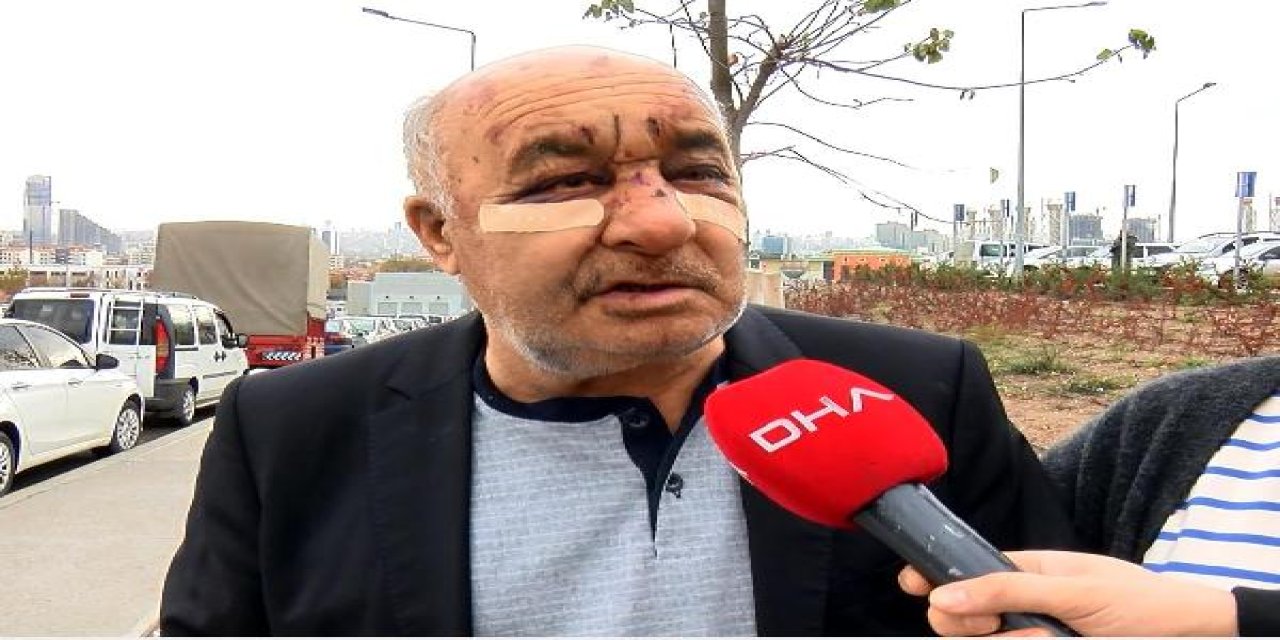 Ankara'da Taksiciyi Dövüp, Gasbeden Şüpheli Yakalandı