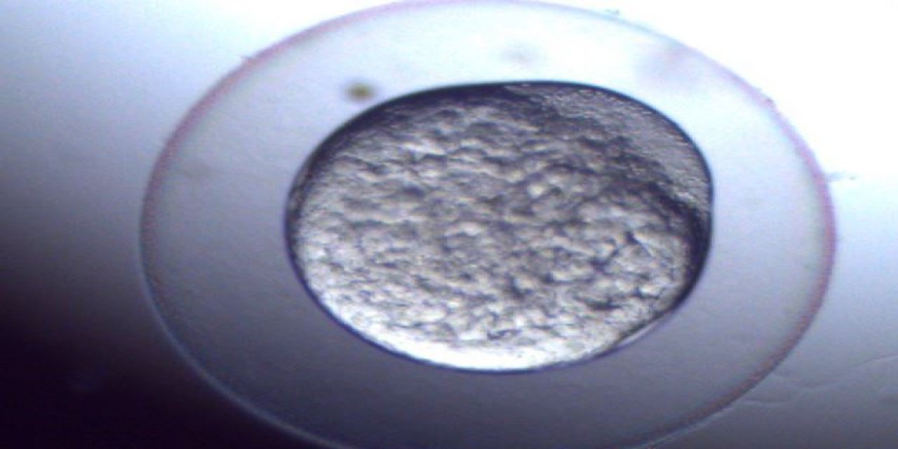 Atık İlaçların İnsan Sağlığına Etkisi Araştırılıyor