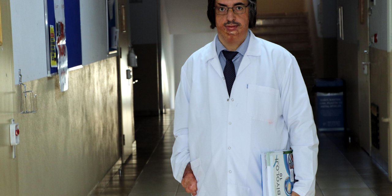 Çocukken Yangında Elini Kaybeden Fethi Öğretmen, Öğrencilerinin Rol Modeli Oldu