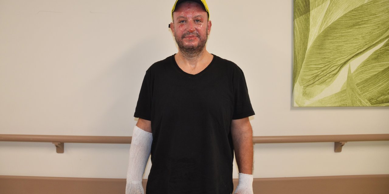 Bursa'da Evde Patlama; Amca İle Yeğeni Yaralandı