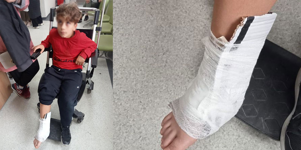 Çatlayan Bileğe 'kartonlu İlk Yardım'a İnceleme