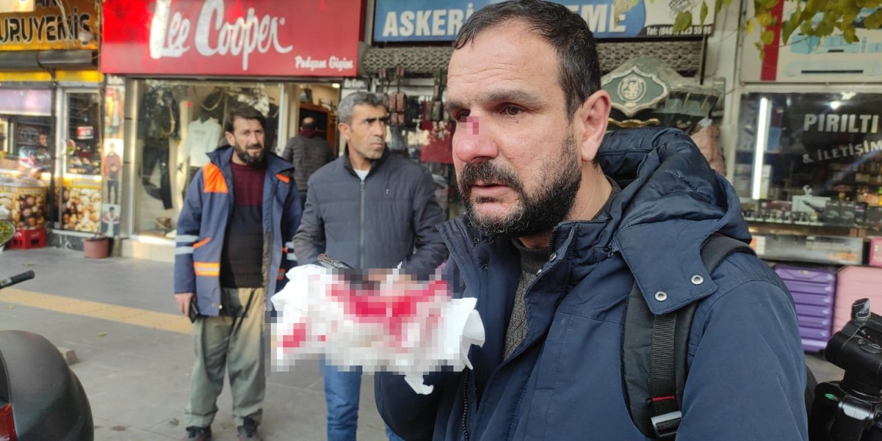 Minibüs Sürücüsü, Aracına Motosikletiyle Çarpan Gazeteciyi Darbetti