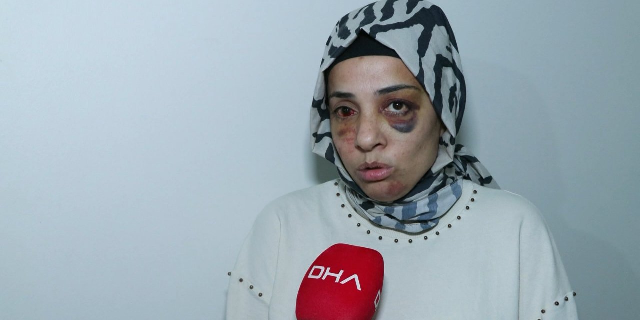 Bağcılar'da Eski Eşinin Ailesi Tarafından Sokak Ortasında Dövülen Kadının Yardım Çağrısı