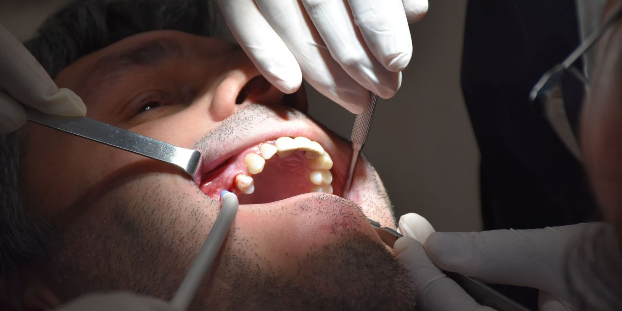 'Sürekli Ağız Kokusunda Sistemik Rahatsızlıklar Araştırılmalı'