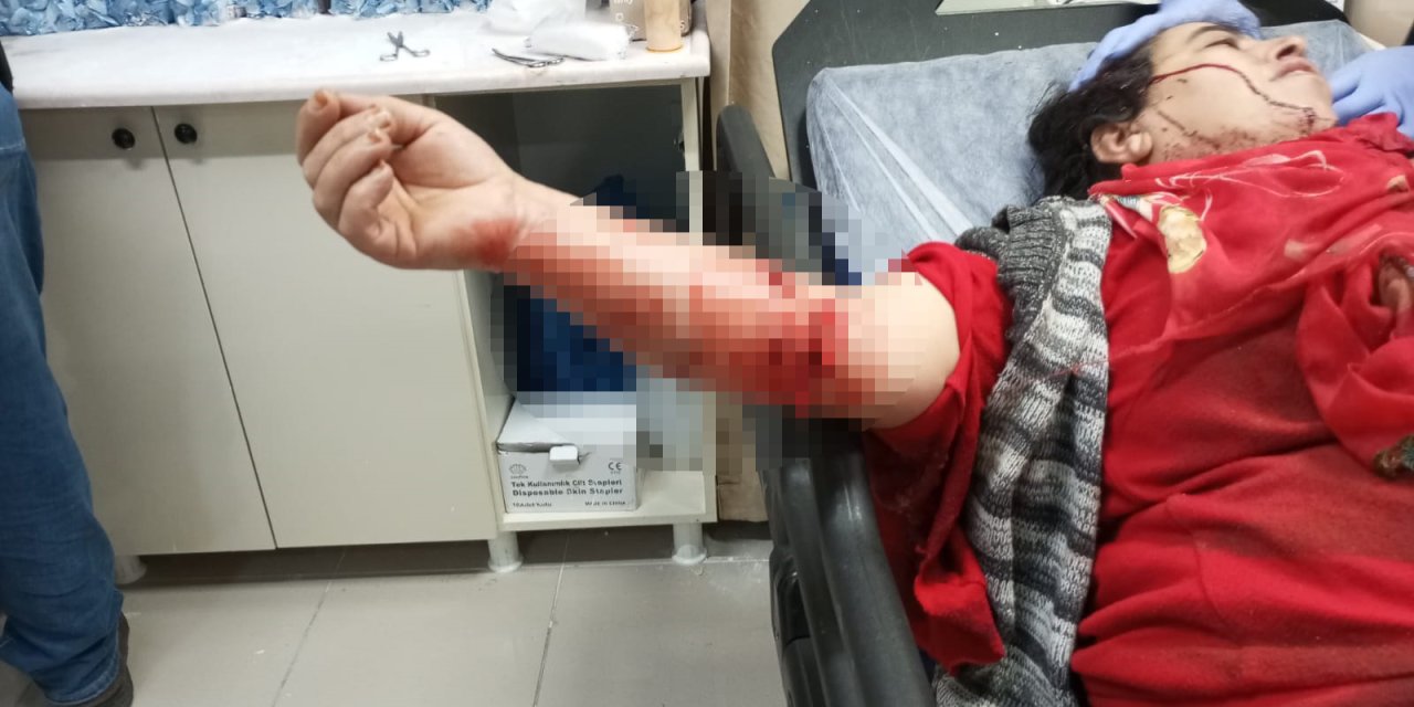 Yasaklı Irk Köpeğin Saldırısına Uğrayan Kadın Yaralandı