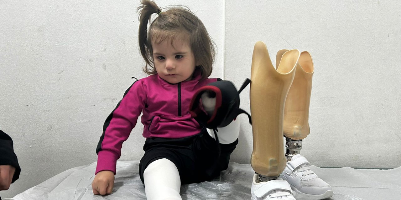 3,5 Yaşındaki Tali, Protez Bacaklarına Kavuştu
