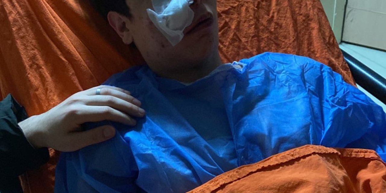 Tabancayla Oynarken Arkadaşını Başından Vurdu; 1 Yaralı, 4 Gözaltı (2)