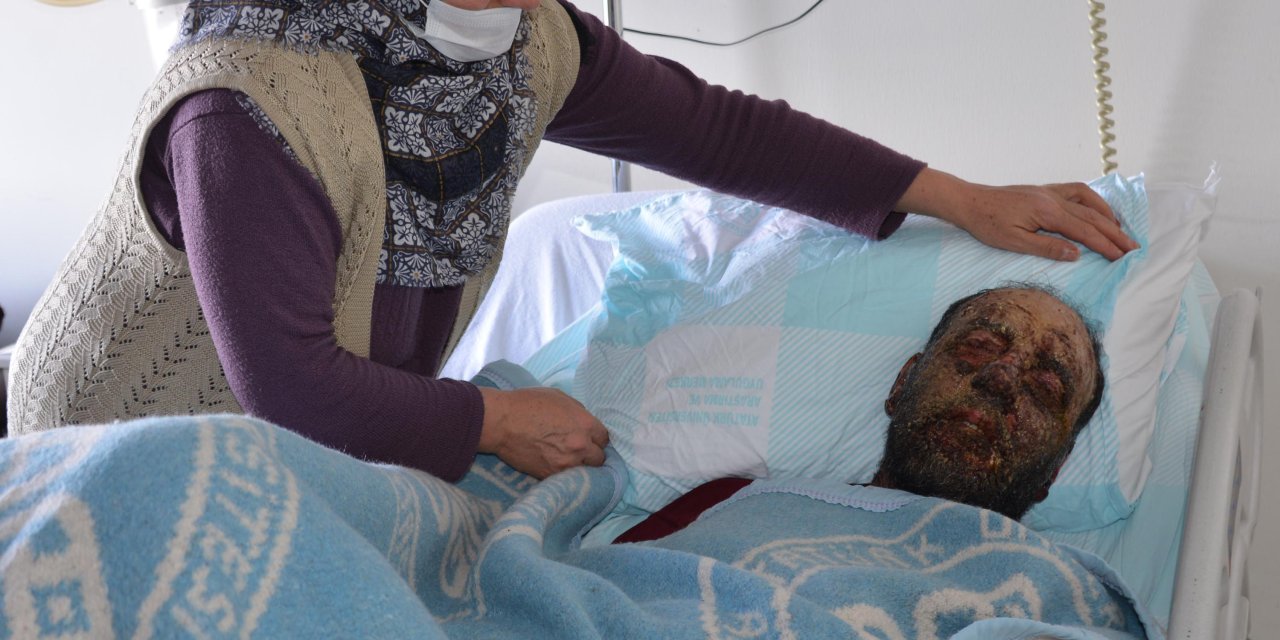 Yağmur Ormanlarında Yaşayanlarda Görülen Hastalık, Yüzünü Tanınmaz Hale Getirdi