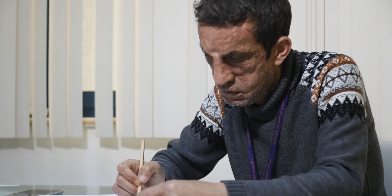 Türkiye'nin İlk Yüz Nakillisi Acar, Üniversiteye Hazırlanıyor