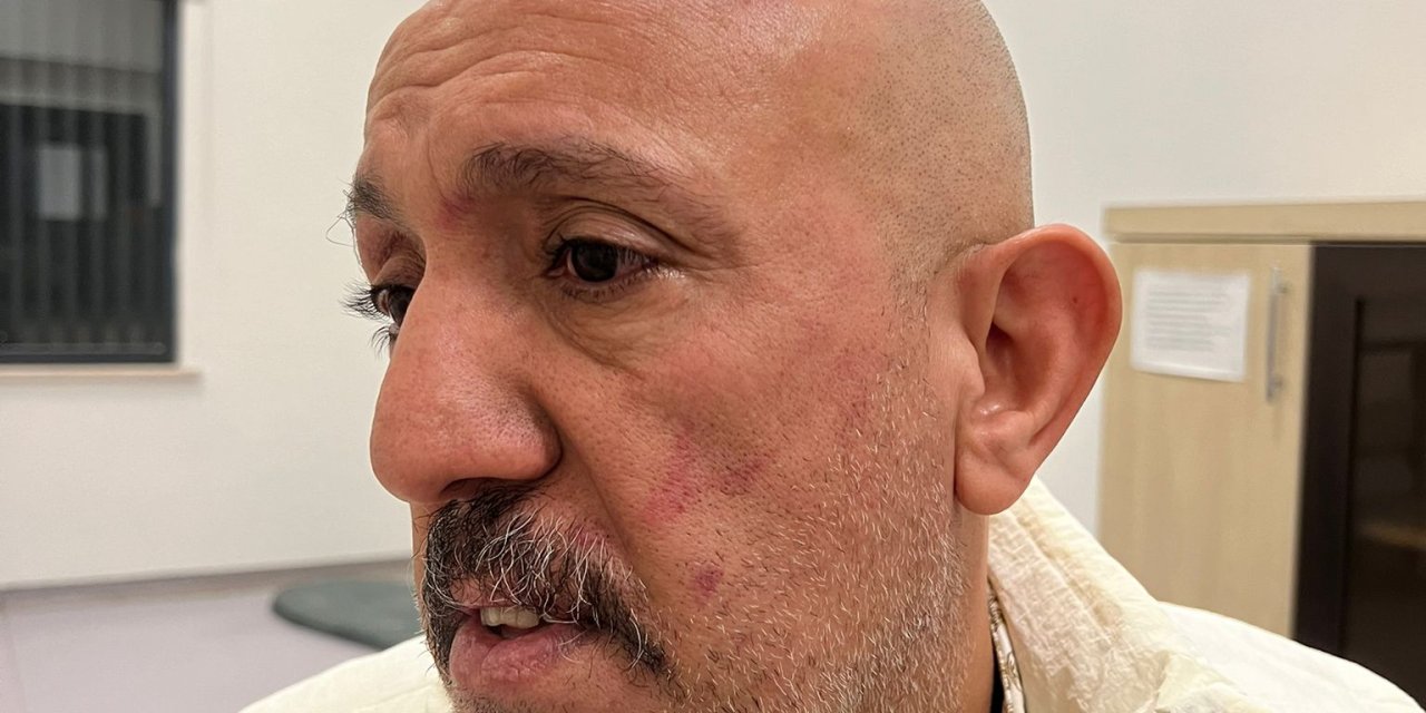 Cezaevi Firarisinin Bekçiler Tarafından Darbedilmesine Soruşturma (2)